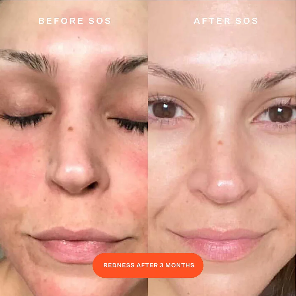 SOS Daily Rescue Facial Spray - Imagen 5