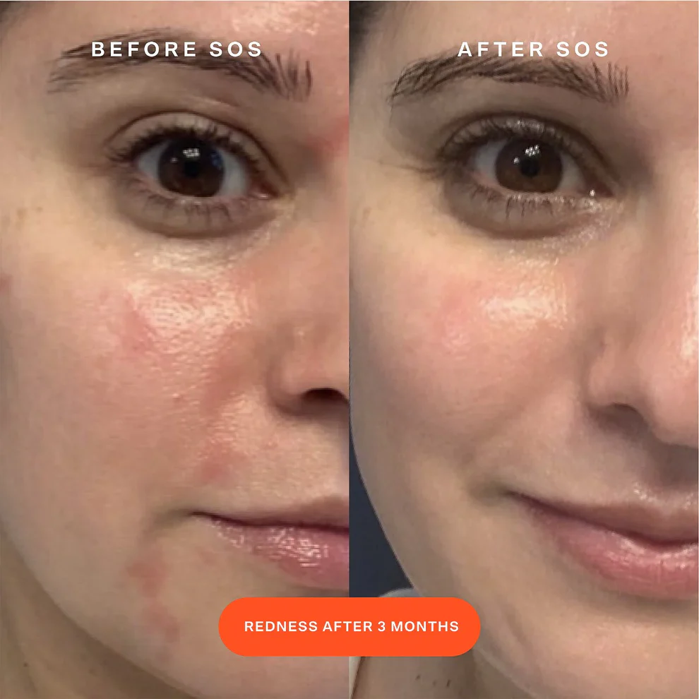 SOS Daily Rescue Facial Spray - Imagen 3